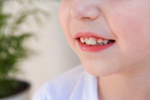 Clínica Dental Carrilet 100