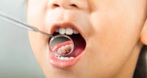 dentista de niños en Hospitalet de Llobregat