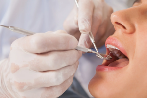 clínica dental en Hospitalet de Llobregat