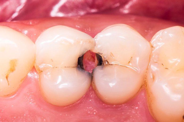 clínica dental en Hospitalet de Llobregat